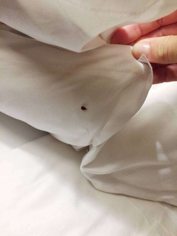 Signs of a bed bug bite